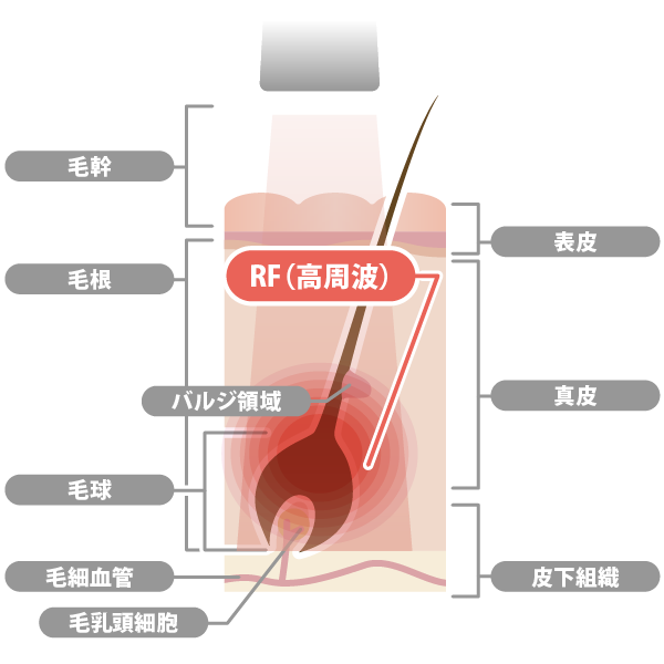 毛周期と脱毛におすすめのタイミング