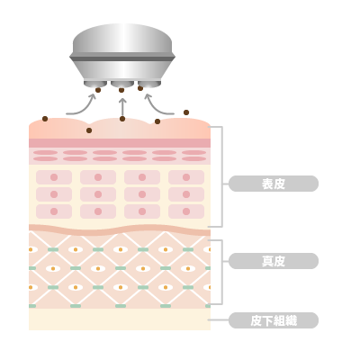 エレクトロクレンジング